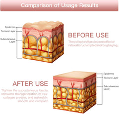 Anti-Aging HIFU, EMS & Microcurrent Device - Ultimate Facial Rejuvenation